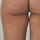 SmartLipo na uda wewn�trzne