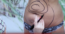 Małgorzata, liposukcja - film na kanale YouTube Dr Osadowska Clinic