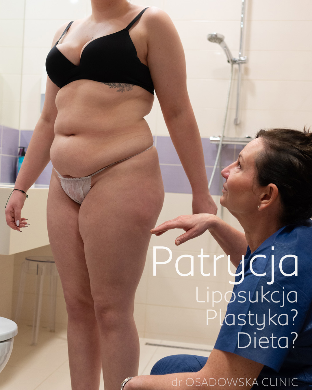 Real photos Brazilian butt lifting, Angelina, before and after surgery - Dr  Osadowska Clinic Poland