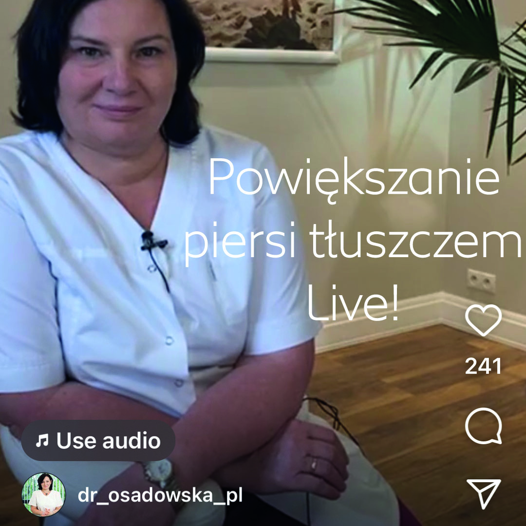 Piersi powiększanie własnym tłuszczem - rozmowa live dr Iloną Osadowską